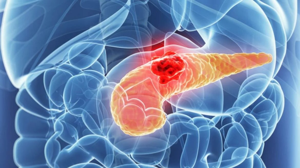 хамгийн үхлийн хорт хавдрын эсрэг вакцин