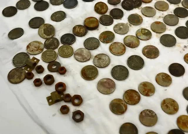 Эрэгтэйн ходоодноос 200 гаруй зоос, боолт, хаалганы нугас гаргажээ 6 Эрэгтэйн ходоодноос 200 гаруй зоос, боолт, хаалганы нугас гаргажээ