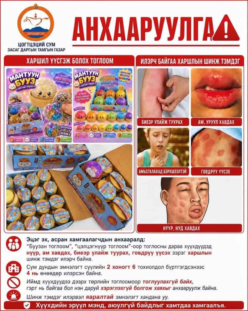 Сэрэмжлүүлэг: Хүүхдийн тоглоомоос үүдэлтэй хордлого, харшлын тохиолдол бүртгэгдлээ 6 Буузан тоглоом